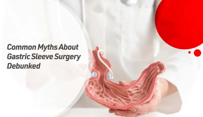 Common Myths About Gastric Sleeve Surgery Debunked