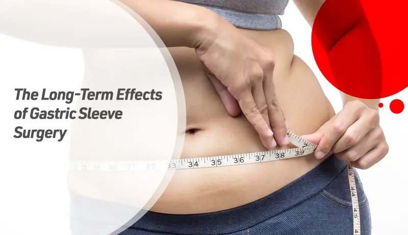 The Long-Term Effects of Gastric Sleeve Surgery