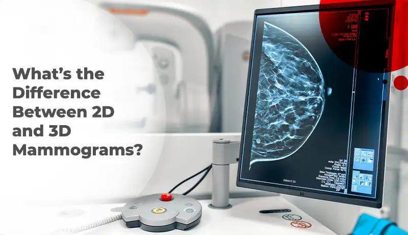 What’s the Difference Between 2D and 3D Mammograms?