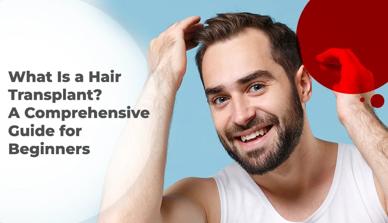 What Is a Hair Transplant? A Comprehensive Guide for Beginners