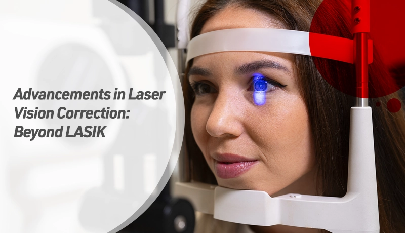 Advancements in Laser Vision Correction: Beyond LASIK