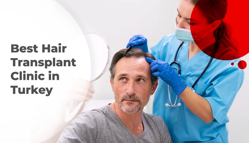 Best Hair Transplant Clinic in Turkey