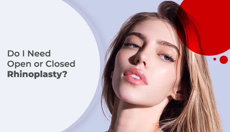 Open vs Closed Rhinoplasty: Crucial Differences and Their Impact