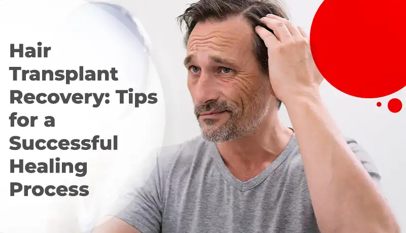 Hair Transplant Recovery: Tips for a Successful Healing Process
