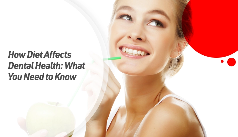 How Diet Affects Dental Health: What You Need to Know