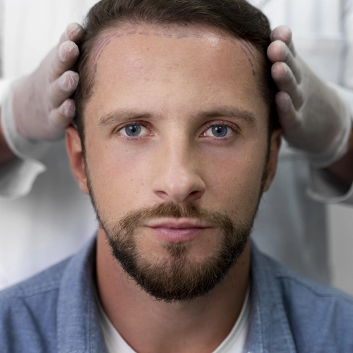 How Technology is Changing the Landscape of Hair Transplant Surgery
