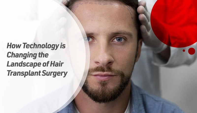 How Technology is Changing the Landscape of Hair Transplant Surgery