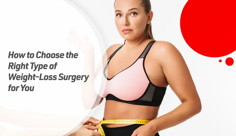 How to Choose the Right Type of Weight-Loss Surgery for You